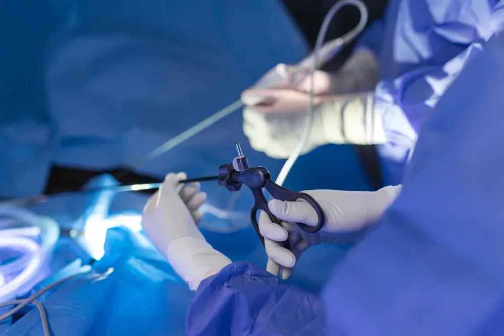 Cirugía de cáncer de colon y recto por laparoscopia o mínima invasión en Puebla