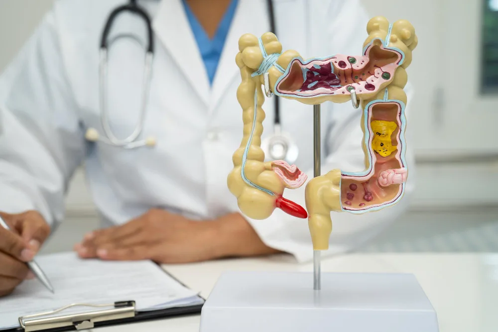 Consulta de Coloproctología